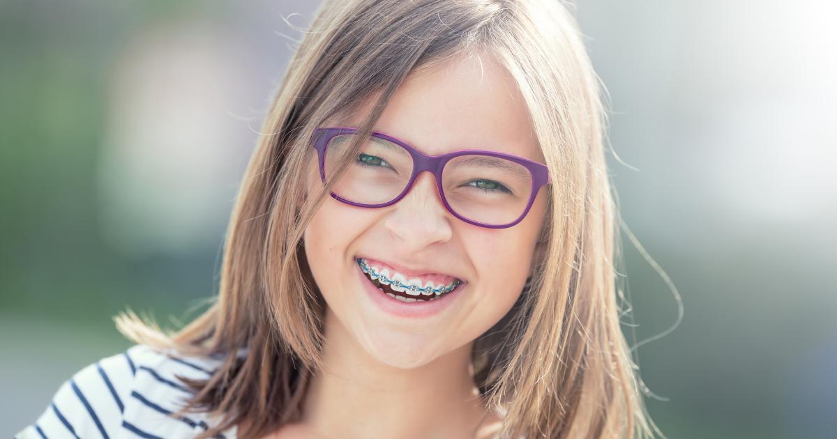 come prevenire i denti storti